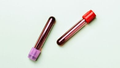 Blood Test for Survival Prediction