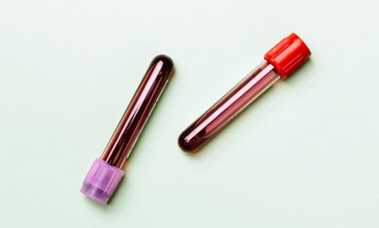 Blood Test for Survival Prediction