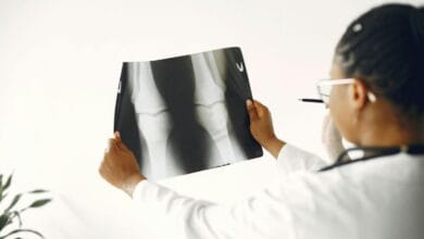 Arthritis Cause Eye Problems