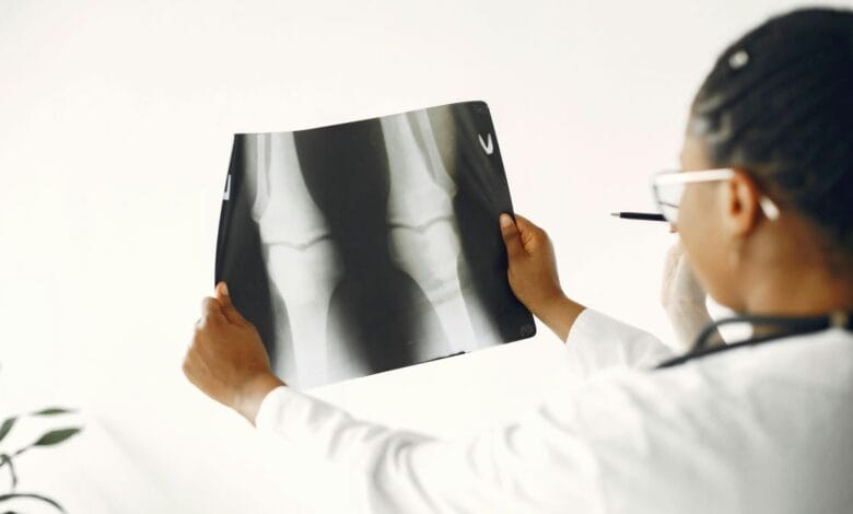 Arthritis Cause Eye Problems