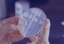 Can Bacteria Cause Breast Cancer? New Research Insights