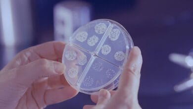 Can Bacteria Cause Breast Cancer? New Research Insights