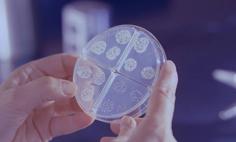 Can Bacteria Cause Breast Cancer? New Research Insights