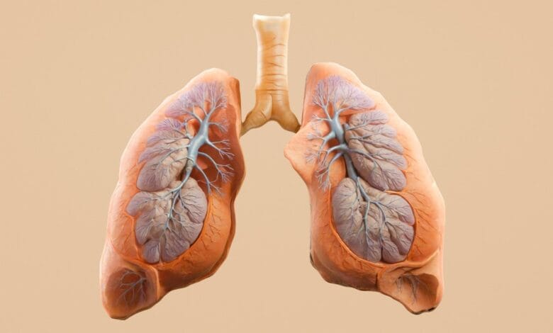 Lung Cancer in People Who Never Smoked is Rising