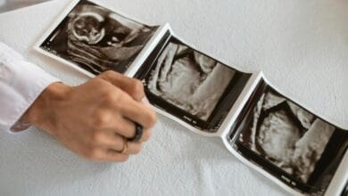 Second Pregnancy Brain Changes: What New Research Reveals