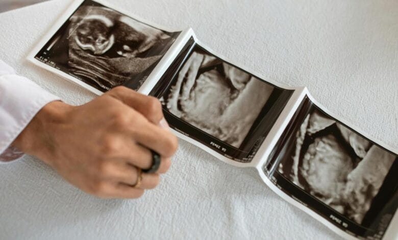 Second Pregnancy Brain Changes: What New Research Reveals