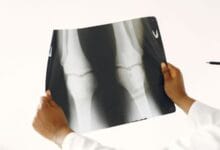 Scientists Found a Way to Regenerate Aging Cartilage