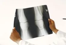 Scientists Found a Way to Regenerate Aging Cartilage