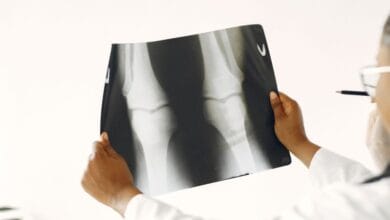 Scientists Found a Way to Regenerate Aging Cartilage