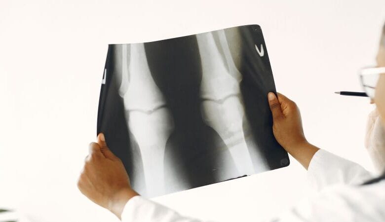 Scientists Found a Way to Regenerate Aging Cartilage