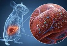 Microplastics Damage the Liver